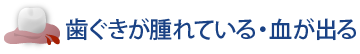歯ぐきが腫れている・血が出る