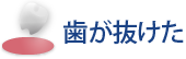 歯が抜けた