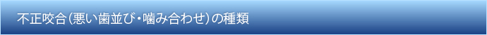 不正咬合（悪い歯並び・噛み合わせ）の種類